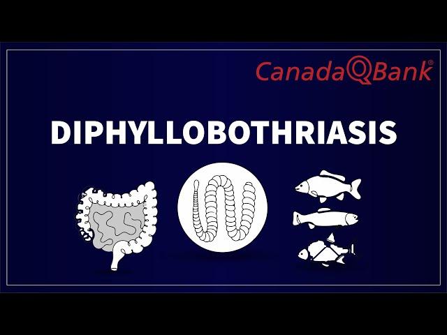 Diphyllobothriasis Explained: Infections, Symptoms, Diagnosis & Treatment | CanadaQBank