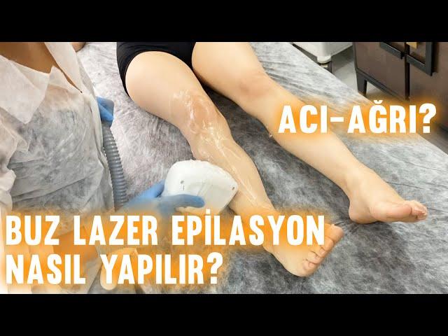 Buz Lazer Epilasyon Bacak Bölgesine Nasıl Yapılır?