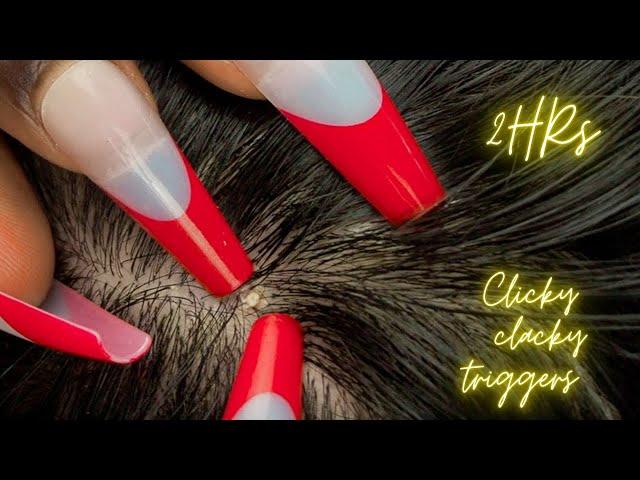 ASMR | 2HRs Intense Nitpicking & Deep Scalp Scratching Triggers - ALLZOOMED