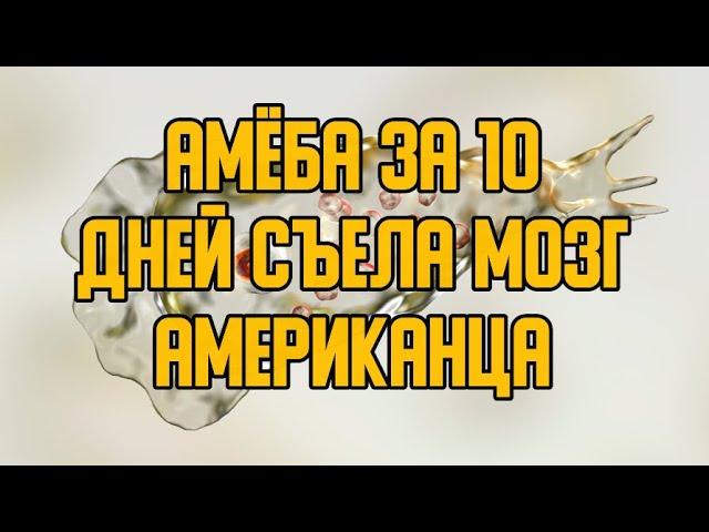 Плотоядная амёба за 10 дней съела мозг Американца