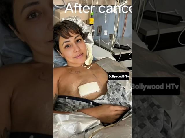 Before cancer&After cancer#hinakhan ️#bollywood#youtubeshorts️