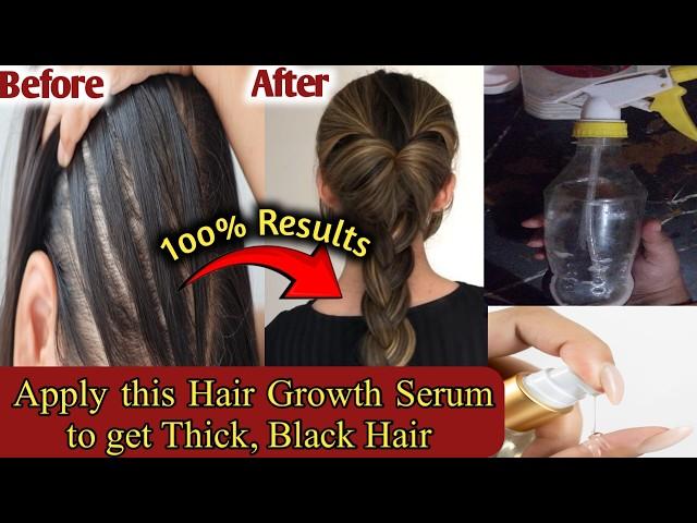 How to make Thin to Thick Hair? | Thining Hair Treatment | 15 Days Hair Growth Challenge