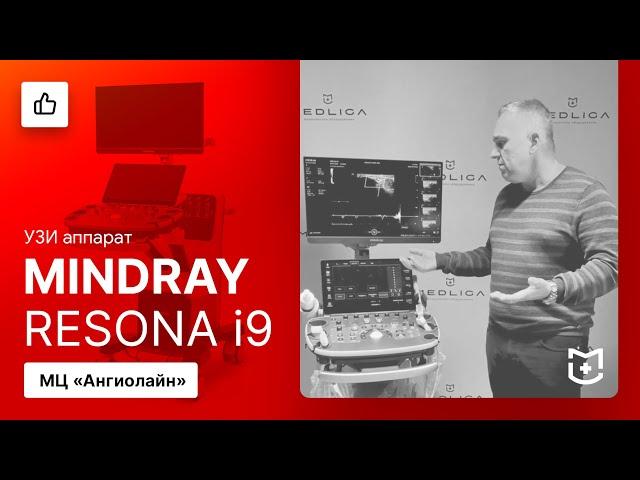 Отзыв на УЗИ аппарат Mindray Resona i9 (МЦ Ангиолайн)