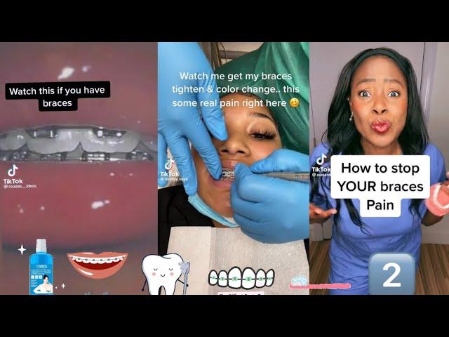 Braces Tips pt.2 TikTok Compilation