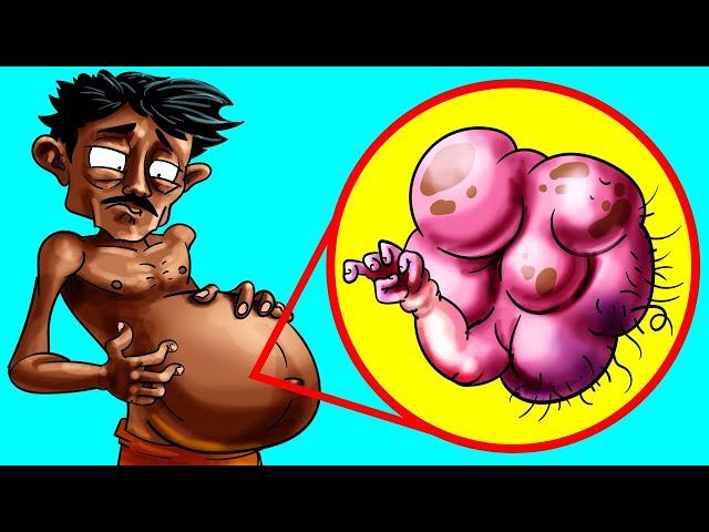 Craziest Things Ever Found In The Human Body