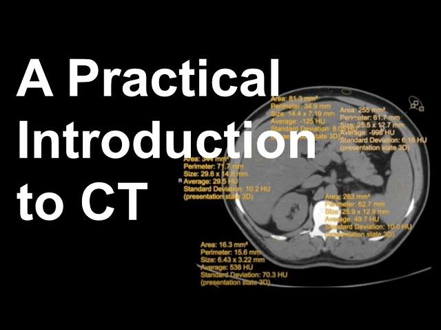 A Practical Introduction to CT