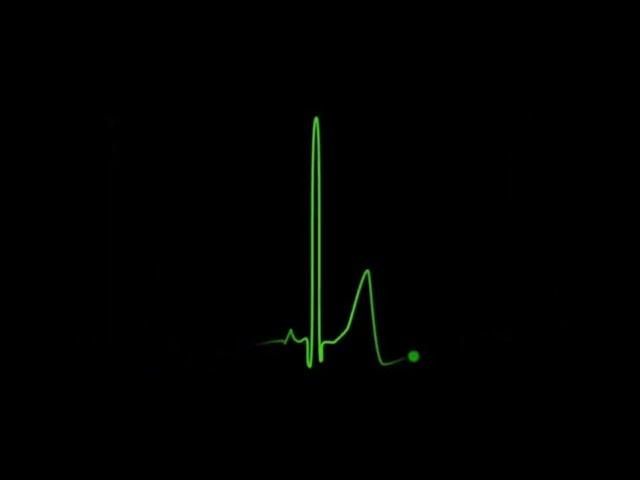 Heartbeat effect |Heartbeat template free |Black screen effect
