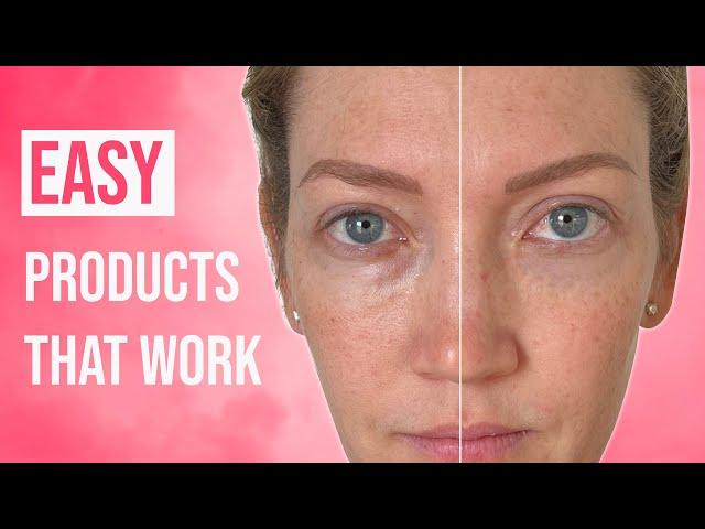 Reduce Dark Under Eye Circles Without Makeup - These Products Will Astonish You!