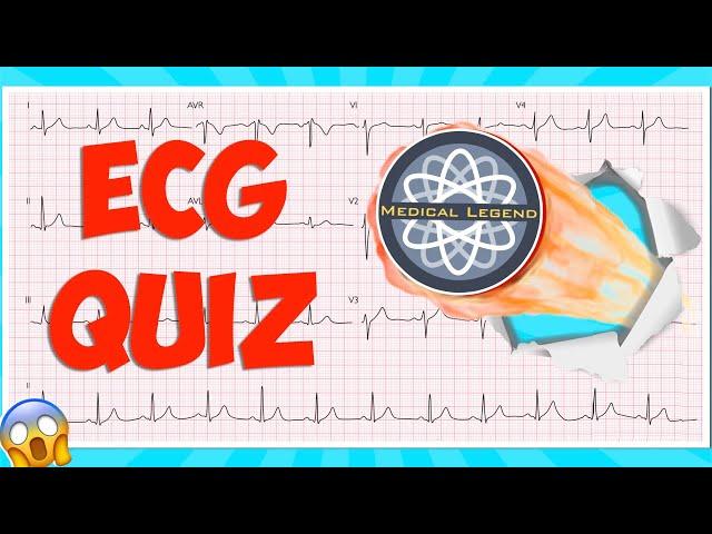 Are You A Medical Legend? Test Your Knowledge With This Ecg/ekg Quiz! #electrocardiogram