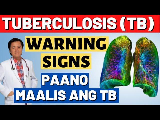 Tuberculosis (TB) Warnings Signs. Paano Maalis ang TB. - By Doc Willie Ong