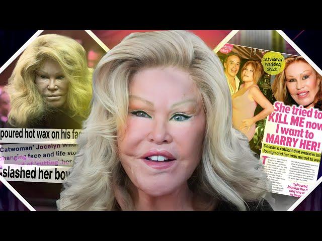 CATWOMAN: Jocelyn Wildenstein's BIZARRE Life and SICK OBSESSION with Plastic Surgery