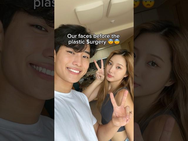 Korean Plastic Surgery is the best 