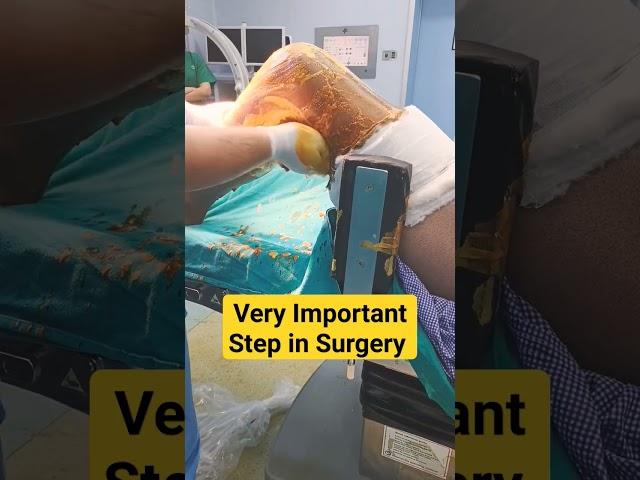 Most Important Step Before any Procedure 