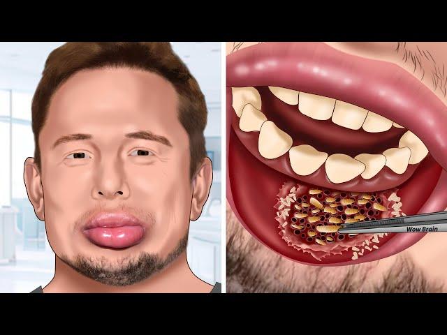 [ASMR] Help Elon Musk treat his swollen lip | WOW Brain Kr Satisfying Video