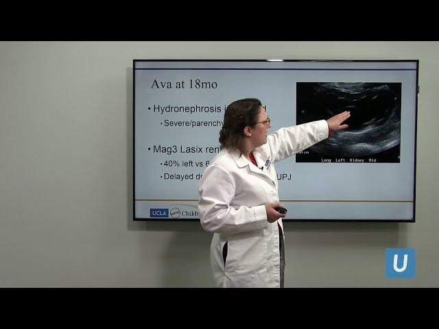 Robotic Surgery in Pediatric Urology | Renea Sturm, MD | UCLAMDChat