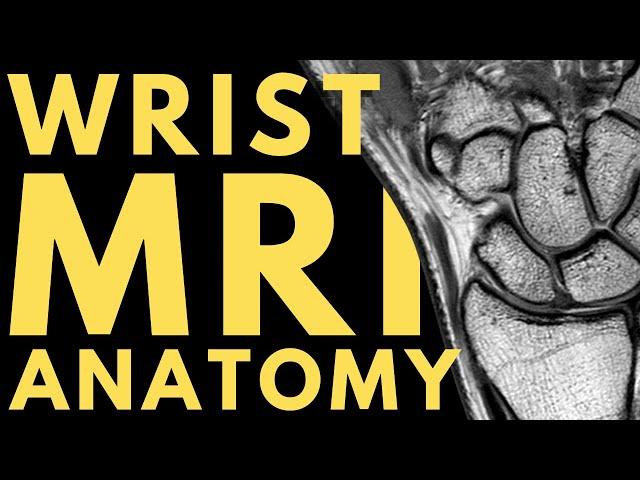 Wrist MRI Anatomy | Radiology anatomy part 1 prep | How to interpret a wrist MRI