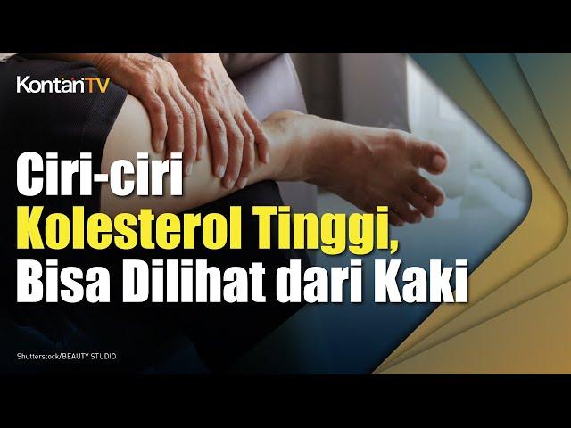 Ciri-ciri Kolesterol Tinggi, Bisa Dilihat dari Kaki | Kontan News