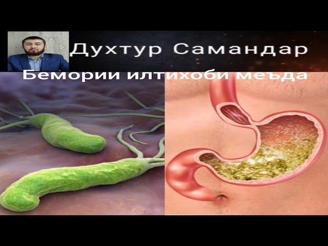 Гастрит! Бемории Илтихоби меъда. Маълумоти пурра.