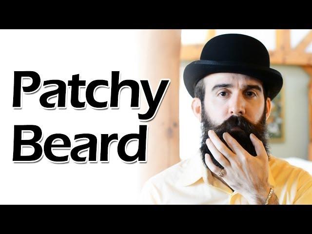 How to Deal with a Patchy Beard