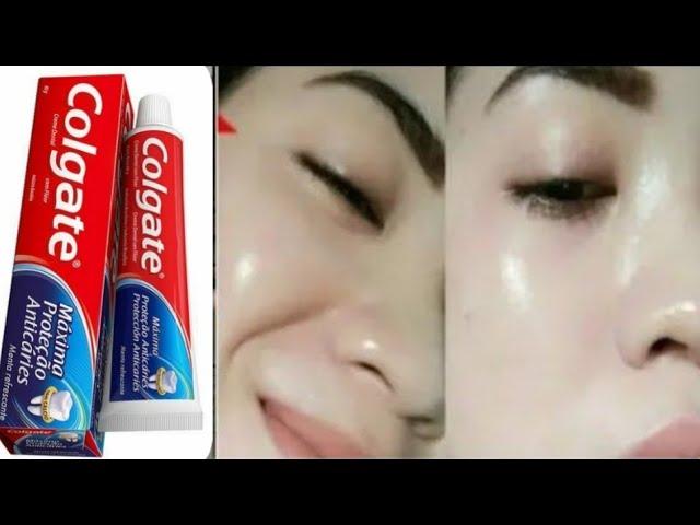 Mask made from ASPIRIN and toothpaste! This skin whitening mask will amaze everyone!