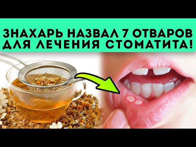 Вы обалдеете! Стоматит исчезает на глазах, если применять эти способы...