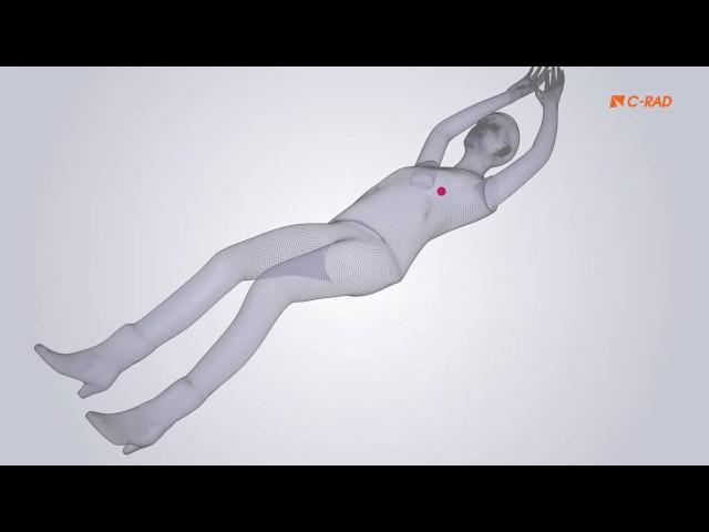 Catalyst HD from C-RAD Positioning AB