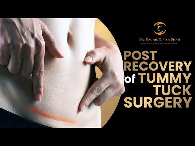 Tummy Tuck Recovery: What to Expect, Timeline, Tips and More