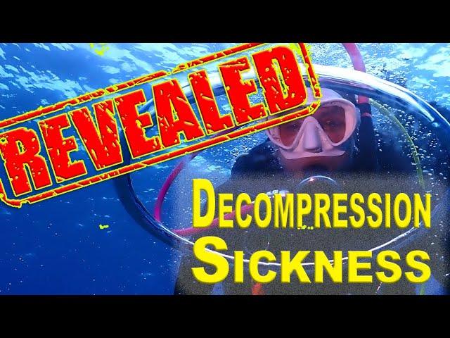 Decompression Sickness DCS Revealed with Professor Simon Mitchell - A Complete Deep Dive