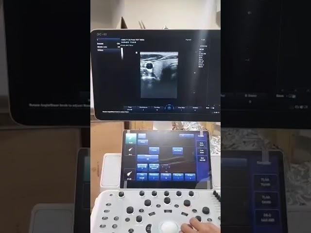 Ultrasounds Minray DC 40/ siêu âm Minray DC 40 test hình ảnh.