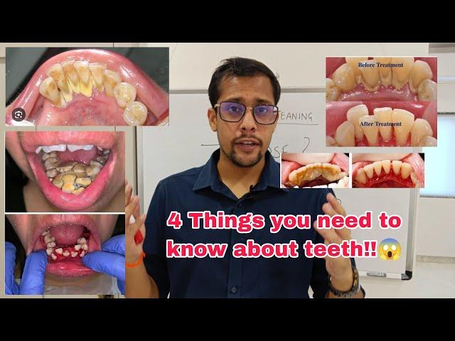 why should I get tooth cleaning!? || teeth cleaning || scaling myths busted