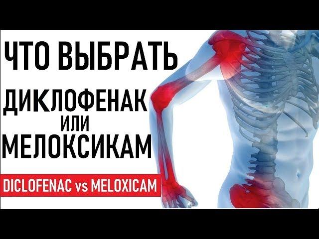 Мелоксикам или Диклофенак что лучше | СОВЕТЫ | Diclofenac (Voltaren) versus Meloxicam (Mobic)