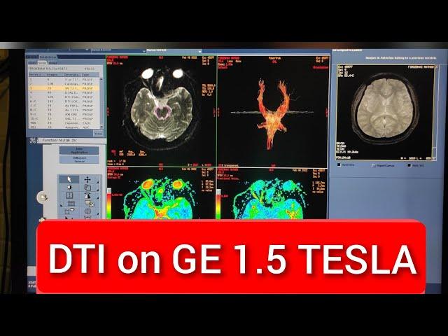 Diffusion Tensor Imaging (DTI) protocol, positioning and planning | Live Demo in English.