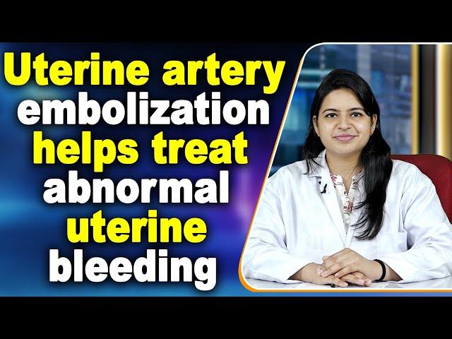 Uterine artery embolization helps treat abnormal uterine bleeding