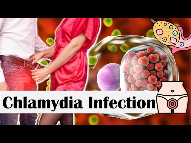 Chlamydia Infection - Causes, Risk Factors, Transmission, Signs & Symptoms, Diagnosis & Treatment