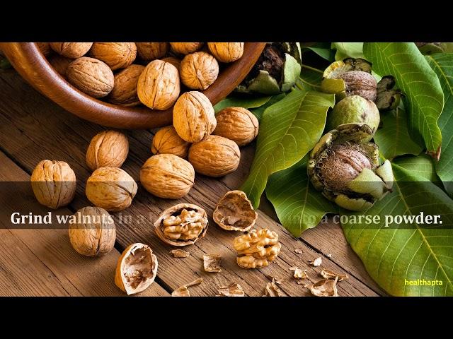 Walnuts for Vitiligo