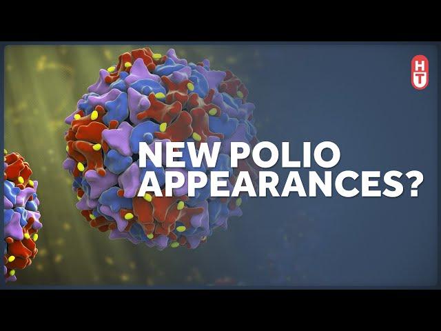 A Polio Case in the United States. What Does it Mean?
