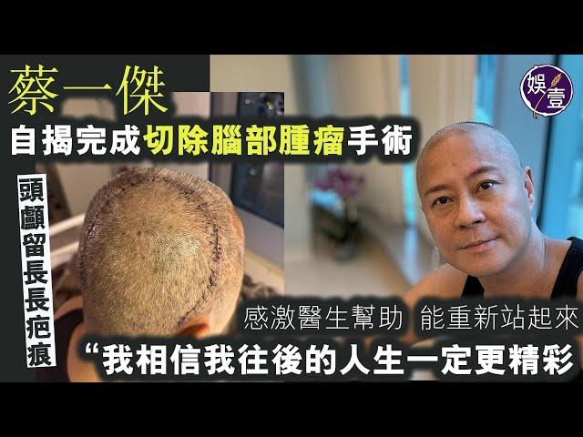 57歲蔡一傑親述完成切除腦部腫瘤手術 頭顱留長長疤痕 感激醫生幫助 能重新站起來：我相信我往後的人生一定更精彩丨錄音訪問丨草蜢（#蔡一傑 #草蜢 #娛壹）