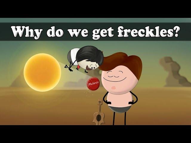 Why do we get freckles? | #aumsum #kids #science #education #children