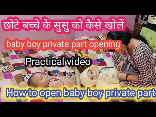 How to open baby boy private part with prectical | छोटे बच्चे के सुसु को कैसे खोलें @Rubyvlogs21