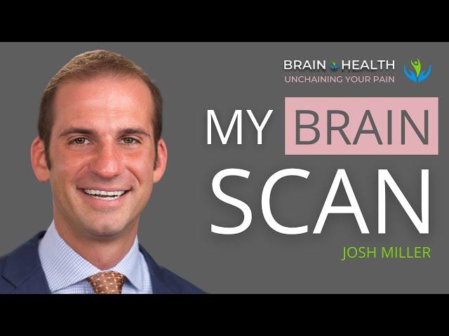 What my SPECT scan taught me about my brain health with Josh Miller | E95