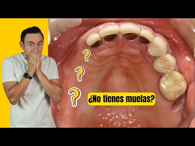 Esto le pasa a tu cuerpo al perder las muelas | ¡Te quedarás con la boca abierta!