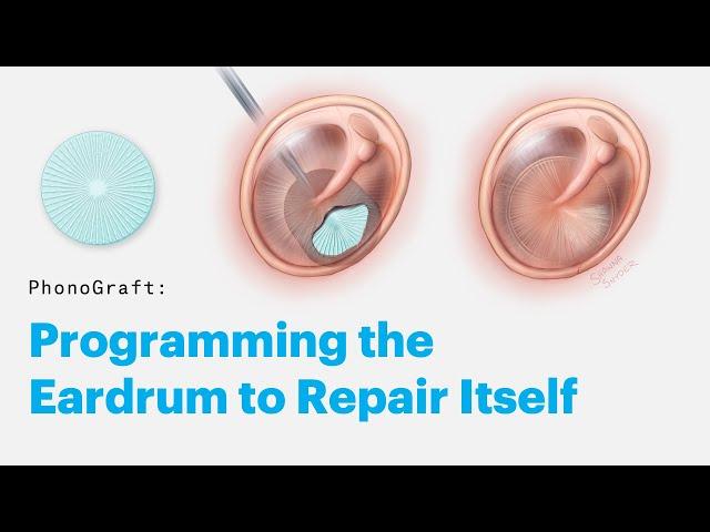 PhonoGraft: Programming the eardrum to repair itself