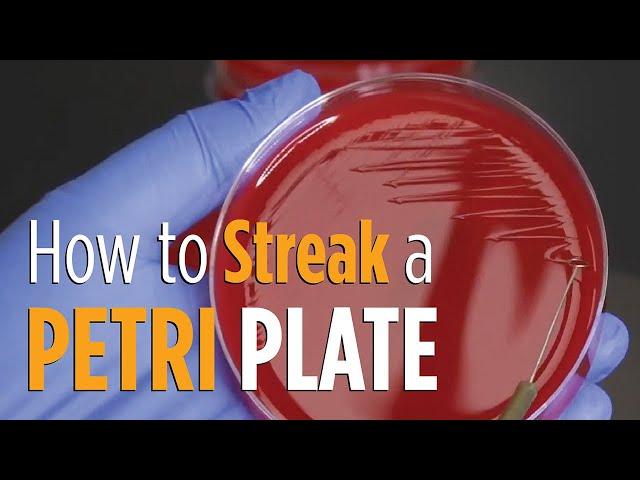 Four Quadrant Streak procedure - How to properly streak a Petri plate for isolated colonies