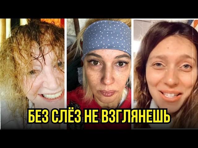 ИСПУГАТЬСЯ МОЖНО! Как выглядят знаменитости без фотошопа и макияжа, звезды без макияжа