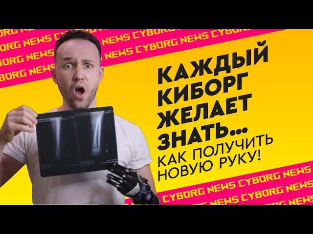 Как получить протез ? | Как оформить ИНВАЛИДНОСТЬ, ИПРА и пройти комиссию МСЭ