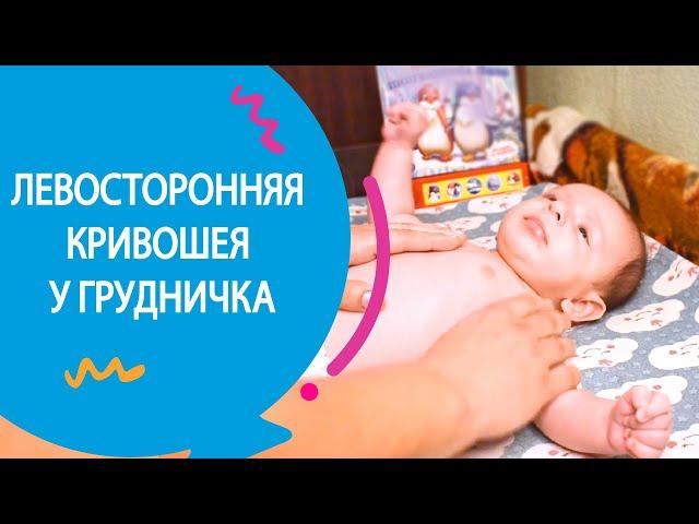 ЛЕВОСТОРОННЯЯ КРИВОШЕЯ У ГРУДНИЧКА 2 МЕСЯЦА