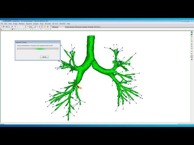 How to Automatically Segment Airways | Mimics Innovation Suite | Materialise Medical