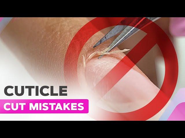 Don'ts When Cutting the Cuticle | Manicure Mistakes