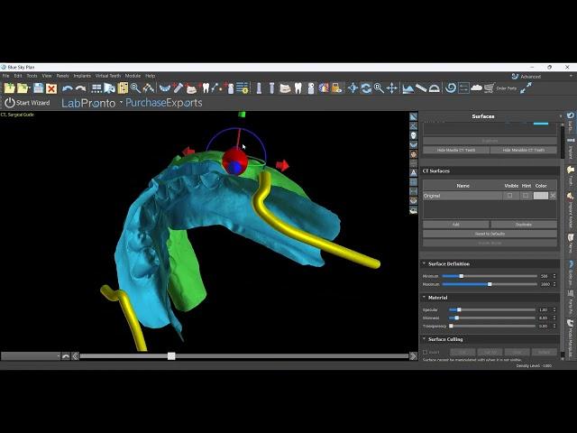 Waxups and Orienting Models in Occlusion in Blue Sky Plan