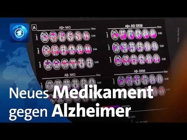 USA lassen neues Alzheimermedikament „Leqembi“ zu